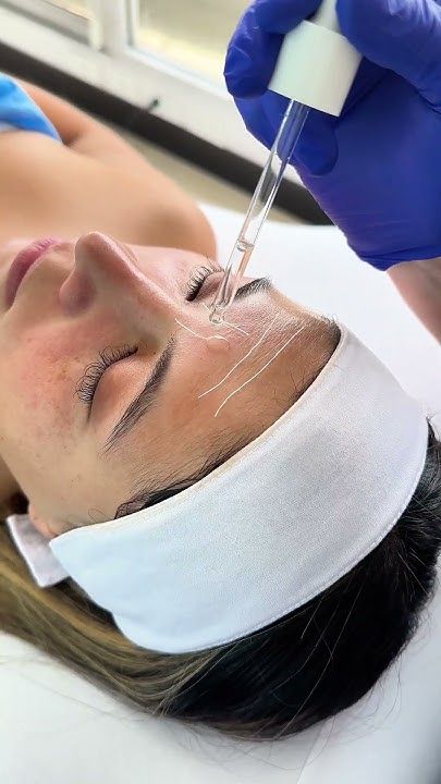Hilos cosmetológicos